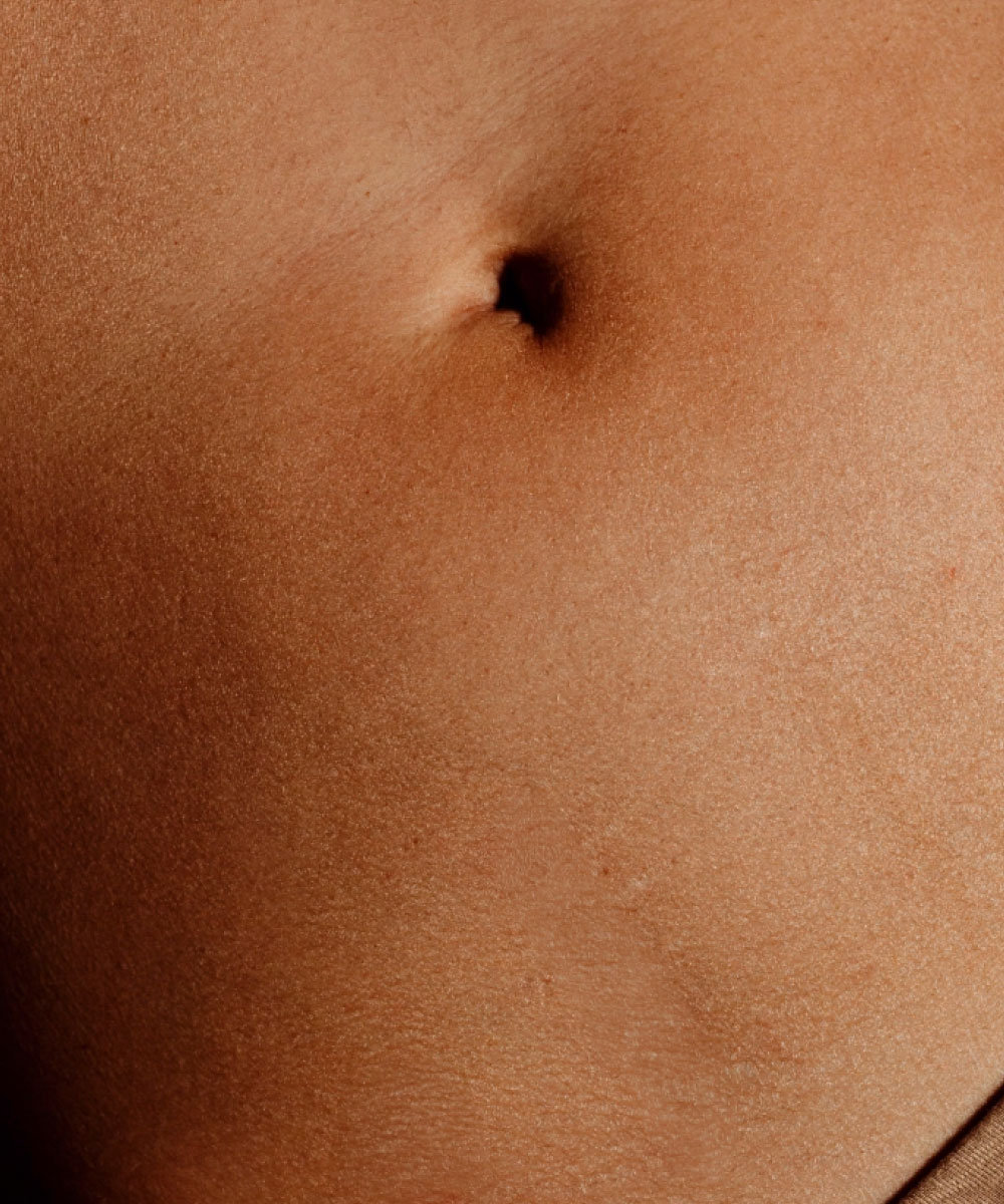 Diástasis abdominal